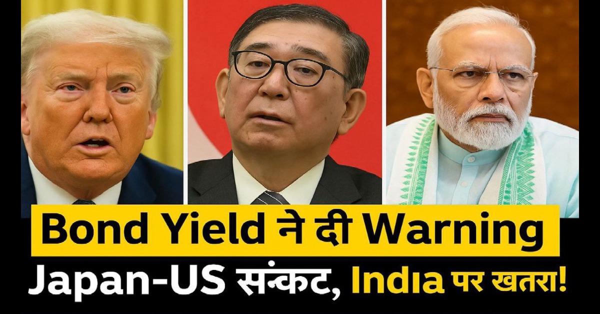 Bond Yield